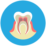 Root Canal Therapy