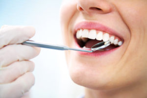 Periodontal Maintenance