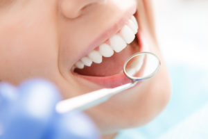 Fishkill Dental Office periodontal maintenance